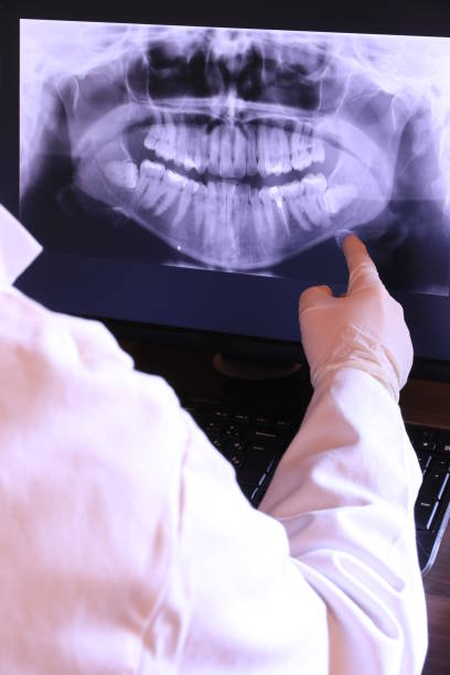 Best Emergency Tooth Extraction in Salem Lakes, WI